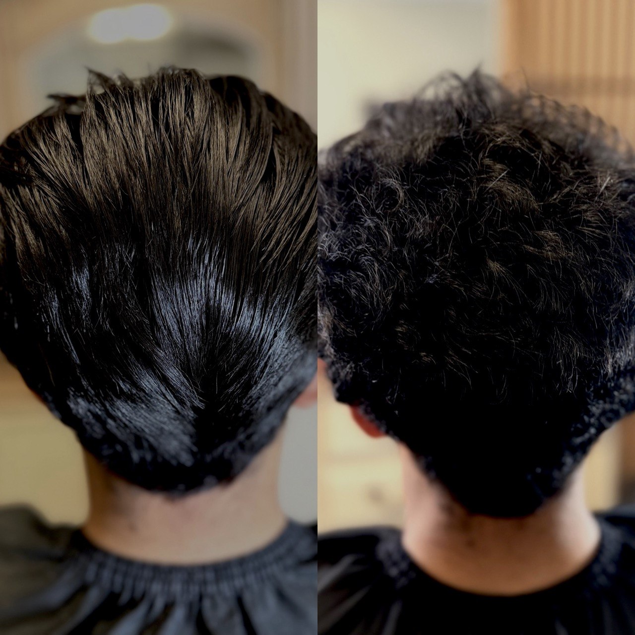 Nanoplasty treatment work 4