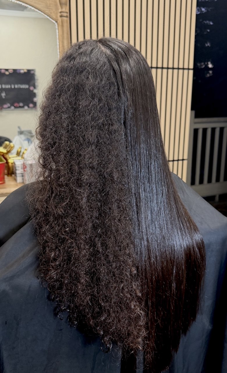 Nanoplasty treatment work 6